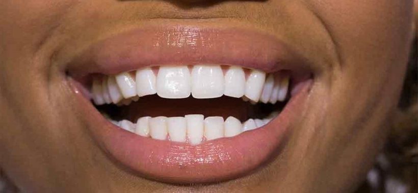TEETH CARE